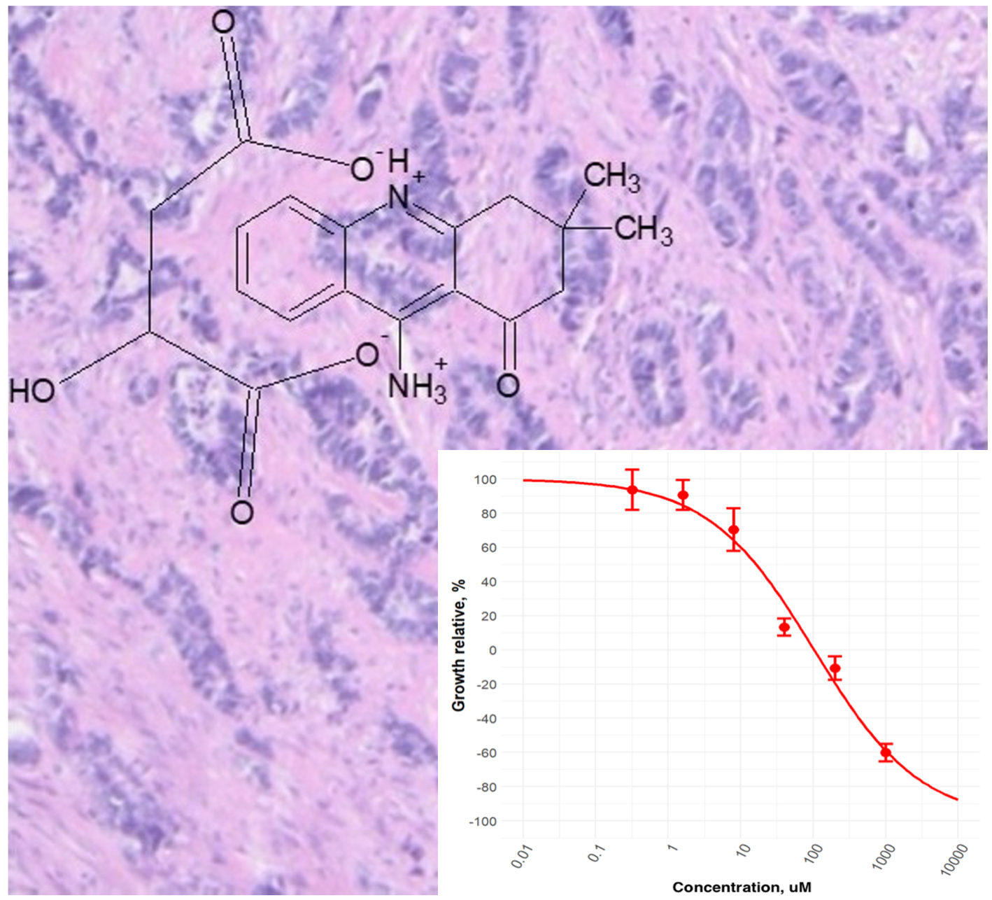 Explanation: Cytoreductive effect of 9-ammonium-3,3-dimethyl-3,4-dihydroacridine-1(2H)-OH L-2-hydroxybutane against triple negative EGFR-expressing breast cancer cells.